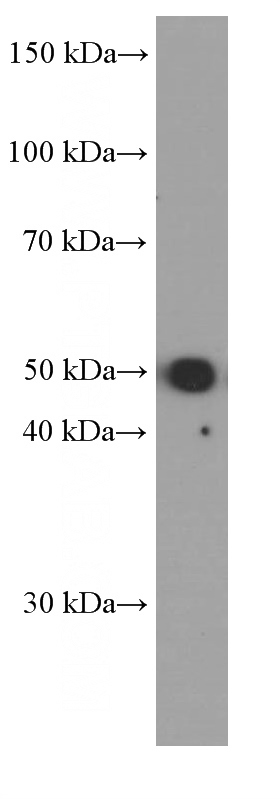 HEK-293 cells were subjected to SDS PAGE followed by western blot with Catalog No:107544(WTAP Antibody) at dilution of 1:2000
