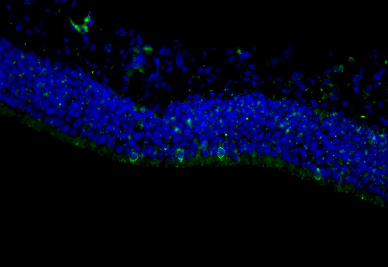 Fluorescent IHC on 1%PLP fixed frozen mouse olfactory epithelium tissue of TRPM5 antibody (Catalog No:116411, 1:200). Microvillar cell staining in the apical layer. By Dr. Brian Lin (Schwob Lab).