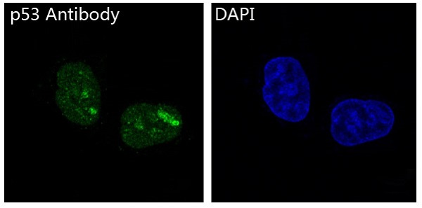 Immunofluorescent analysis of Hela cells, using p53 Antibody .