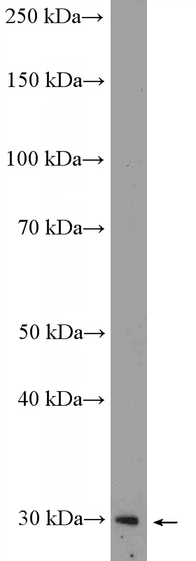 SH-SY5Y cells were subjected to SDS PAGE followed by western blot with Catalog No:112911(MXI1 Antibody) at dilution of 1:300