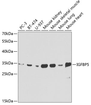 Western blot - IGFBP5 Polyclonal Antibody 