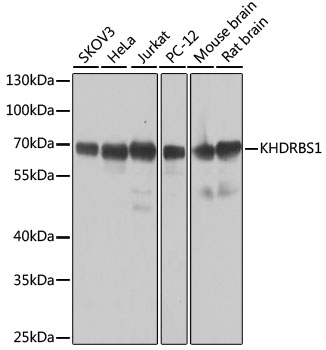 Western blot - KHDRBS1 Polyclonal Antibody 