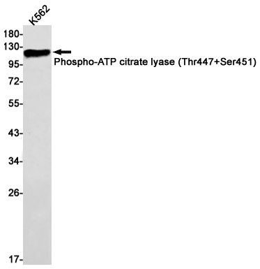 Western blot detection of Phospho-ATP citrate lyase (Thr447+Ser451) in K562 cell lysates using Phospho-ATP citrate lyase (Thr447+Ser451) Rabbit mAb(1:1000 diluted).Predicted band size:121kDa.Observed band size:121kDa.