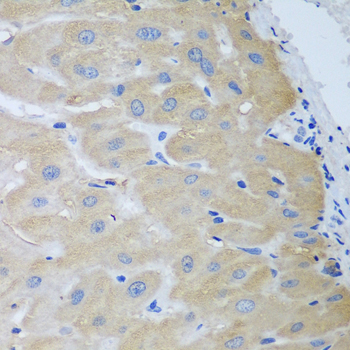 Immunohistochemistry - NME4 Polyclonal Antibody 