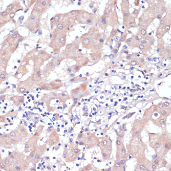 Immunohistochemistry - WNT5B Polyclonal Antibody 