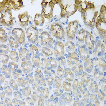 Immunohistochemistry - CXCR4 Polyclonal Antibody 