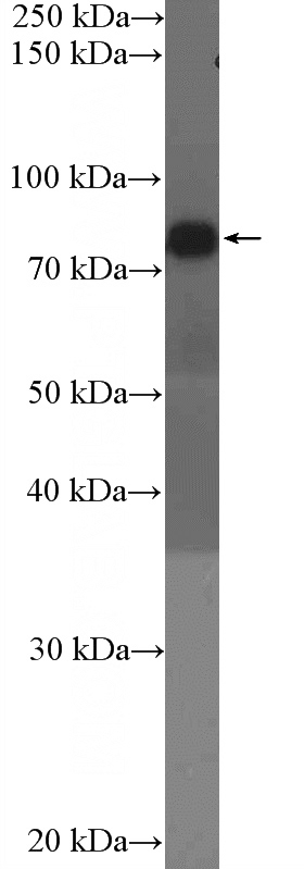ROS1728 cells were subjected to SDS PAGE followed by western blot with Catalog No:110982(GIT1 Antibody) at dilution of 1:1000