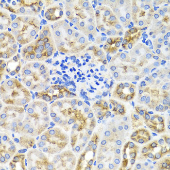 Immunohistochemistry - PRKAG1 Polyclonal Antibody 