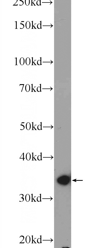 mouse lung tissue were subjected to SDS PAGE followed by western blot with Catalog No:113629(PDLIM1,CLP36 Antibody) at dilution of 1:600