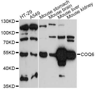 Western blot - COQ6 Polyclonal Antibody 