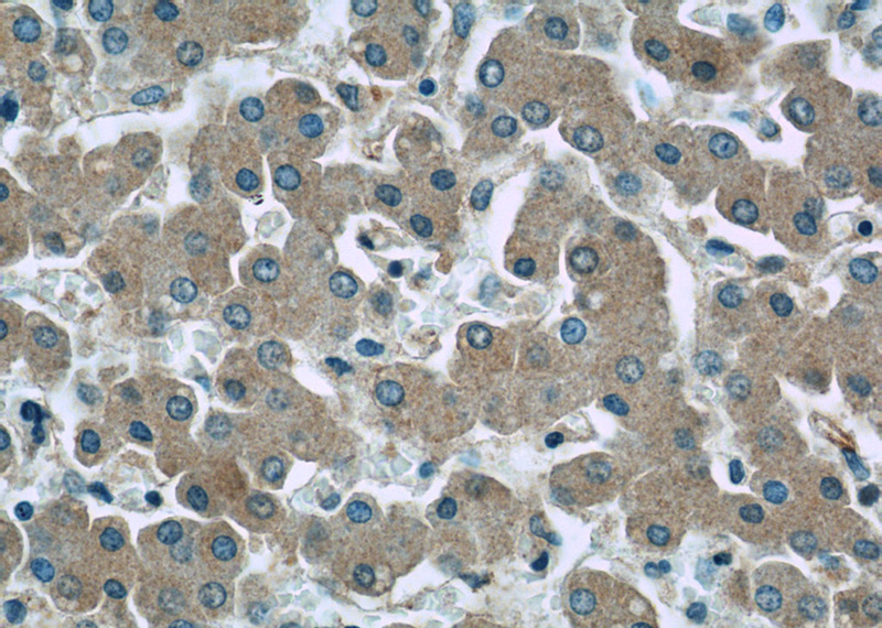 Immunohistochemistry of paraffin-embedded human liver slide using Catalog No:115039(SAA4 Antibody) at dilution of 1:50