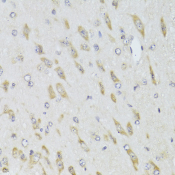 Immunohistochemistry - RPL13 Polyclonal Antibody 