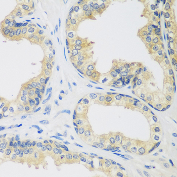 Immunohistochemistry - UPF2 Polyclonal Antibody 