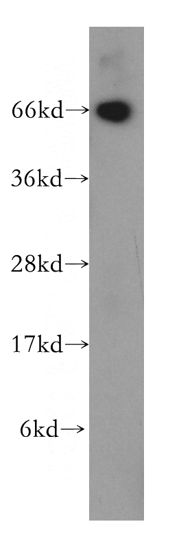 Jurkat cells were subjected to SDS PAGE followed by western blot with Catalog No:113396(NT5E,CD73 antibody) at dilution of 1:400