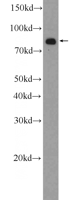 HeLa cells were subjected to SDS PAGE followed by western blot with Catalog No:108385(BCHE Antibody) at dilution of 1:600