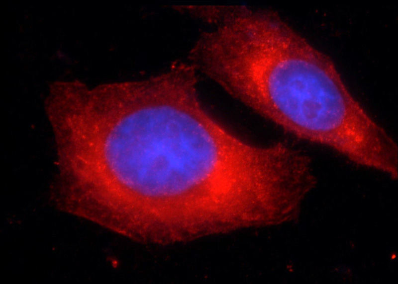 Immunofluorescent analysis of HepG2 cells using Catalog No:109939(DICER1 Antibody) at dilution of 1:25 and Rhodamine-Goat anti-Rabbit IgG