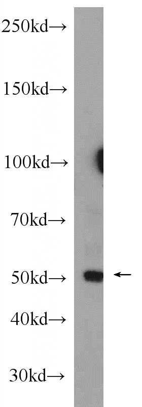 mouse placenta tissue were subjected to SDS PAGE followed by western blot with Catalog No:110330(ENTPD1 Antibody) at dilution of 1:300