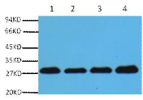 Western blot analysis of Hela (1), Rat brain (2), NIH 3T3 (3), 293T (4), diluted at 1:5000.