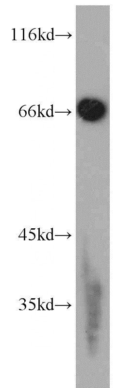 RAW264.7 cells were subjected to SDS PAGE followed by western blot with Catalog No:110219(EGR1 antibody) at dilution of 1:800