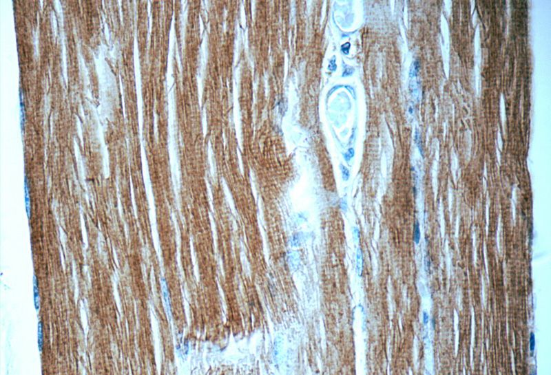Immunohistochemistry of paraffin-embedded human skeletal muscle tissue slide using Catalog No:112976(MYLPF Antibody) at dilution of 1:50 (under 40x lens)