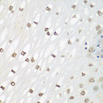 Immunohistochemistry - FOSL2 Polyclonal Antibody 