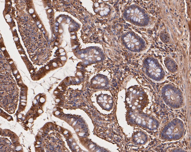 Fig3:; Immunohistochemical analysis of paraffin-embedded human small intestine tissue using anti-TNFRSF19 antibody. The section was pre-treated using heat mediated antigen retrieval with Tris-EDTA buffer (pH 8.0-8.4) for 20 minutes.The tissues were blocked in 5% BSA for 30 minutes at room temperature, washed with ddH; 2; O and PBS, and then probed with the primary antibody ( 1/50) for 30 minutes at room temperature. The detection was performed using an HRP conjugated compact polymer system. DAB was used as the chromogen. Tissues were counterstained with hematoxylin and mounted with DPX.