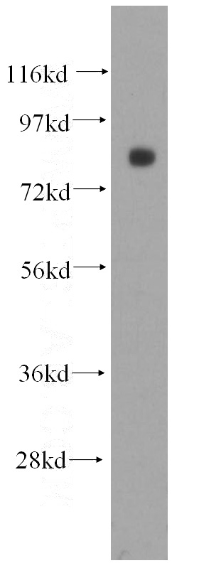 Raji cells were subjected to SDS PAGE followed by western blot with Catalog No:107684(ABCB6 antibody) at dilution of 1:500