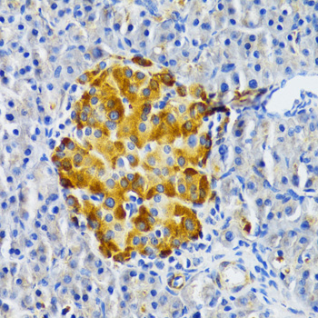Immunohistochemistry - EDA Polyclonal Antibody 