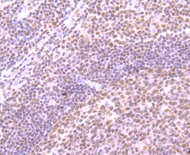 Fig5: Immunohistochemical analysis of paraffin-embedded human tonsil tissue using anti-SMC3 antibody. Counter stained with hematoxylin.