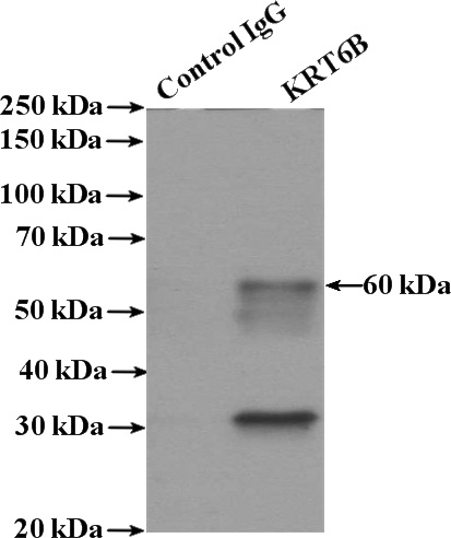 IP Result of anti-KRT6B (IP:Catalog No:112134, 4ug; Detection:Catalog No:112134 1:800) with mouse skin tissue lysate 3200ug.