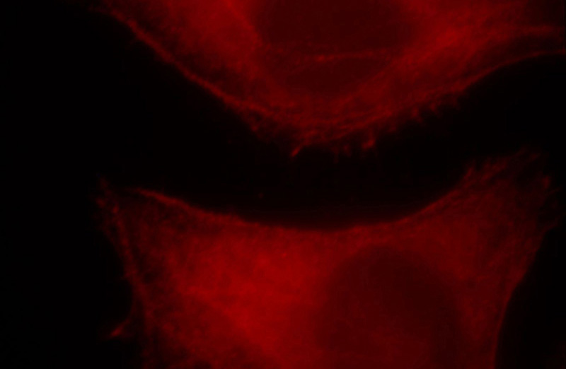 Immunofluorescent analysis of HepG2 cells, using MYH10 antibody Catalog No:112930 at 1:25 dilution and Rhodamine-labeled goat anti-rabbit IgG (red).