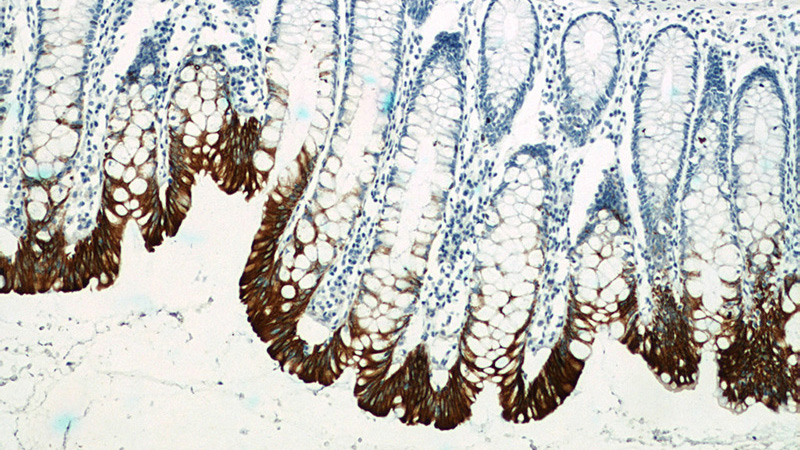 Immunohistochemistry of paraffin-embedded human colon tissue slide using Catalog No:107233(KRT20 Antibody) at dilution of 1:400 (under 10x lens). Heat mediated antigen retrieved with Citric acid buffer, pH6.0