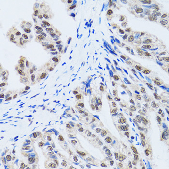 Immunohistochemistry - MTA3 Polyclonal Antibody 