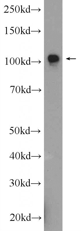 mouse brain tissue were subjected to SDS PAGE followed by western blot with Catalog No:108119(AP2A2 Antibody) at dilution of 1:300