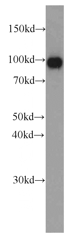 human kidney tissue were subjected to SDS PAGE followed by western blot with Catalog No:107539(VIL1 antibody) at dilution of 1:1000