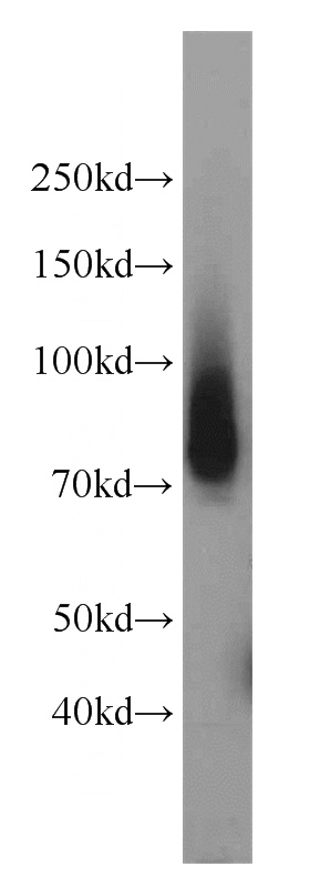 mouse lung tissue were subjected to SDS PAGE followed by western blot with Catalog No:111159(PCDGF,GRN antibody) at dilution of 1:1000