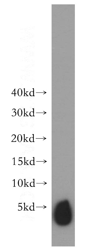 human heart tissue were subjected to SDS PAGE followed by western blot with Catalog No:115410(SLN antibody) at dilution of 1:300