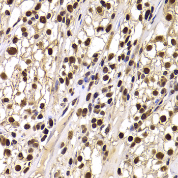 Immunohistochemistry - HIRIP3 Polyclonal Antibody 