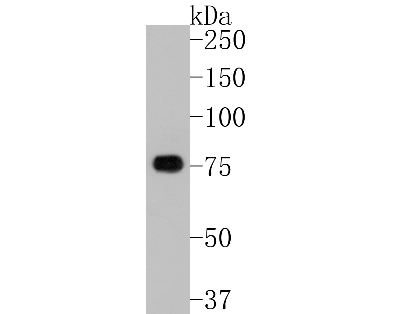 Anti-TBR1 antibody