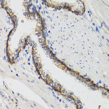 Immunohistochemistry - ATP1A Polyclonal Antibody 