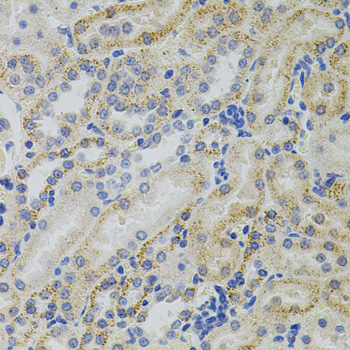Immunohistochemistry - CRHR2 Polyclonal Antibody 
