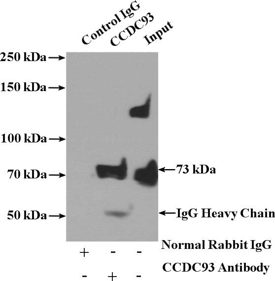 IP Result of anti-CCDC93 (IP:Catalog No:108992, 4ug; Detection:Catalog No:108992 1:500) with L02 cells lysate 1800ug.