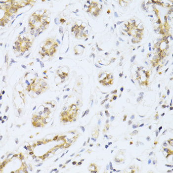 Immunohistochemistry - ETV1 Polyclonal Antibody 