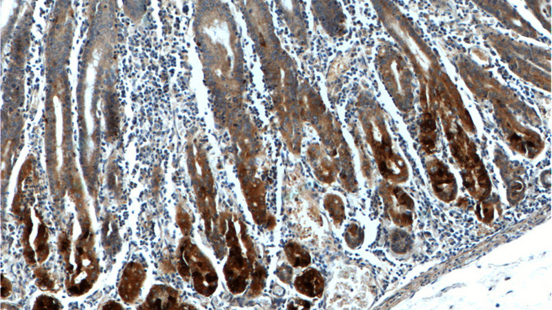 Immunohistochemistry of paraffin-embedded human stomach tissue slide using Catalog No:111123(GPR21 Antibody) at dilution of 1:100 (under 10x lens).