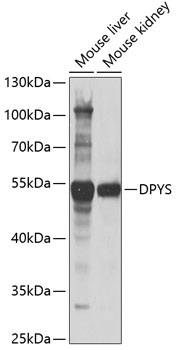 Western blot - DPYS Polyclonal Antibody 