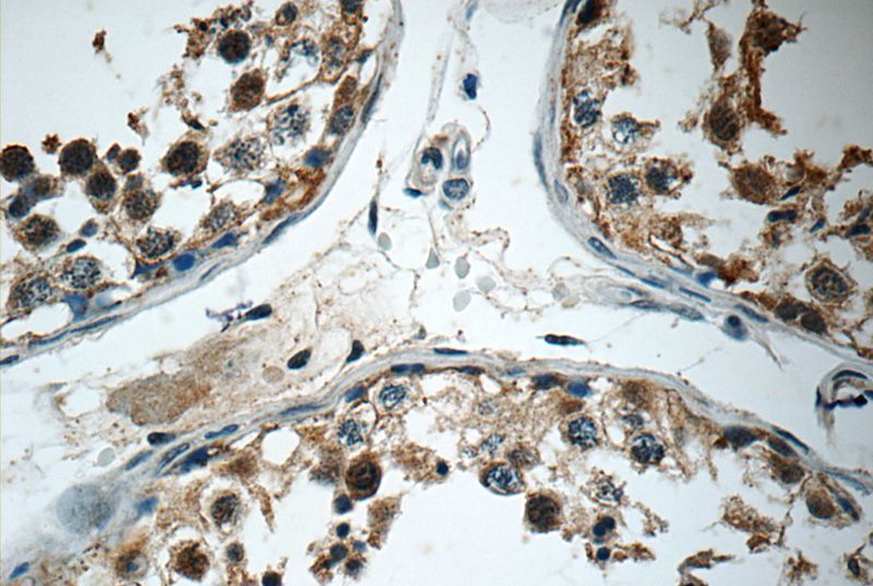 Immunohistochemistry of paraffin-embedded human testis tissue slide using Catalog No:114207(PRMT5 Antibody) at dilution of 1:50 (under 40x lens)