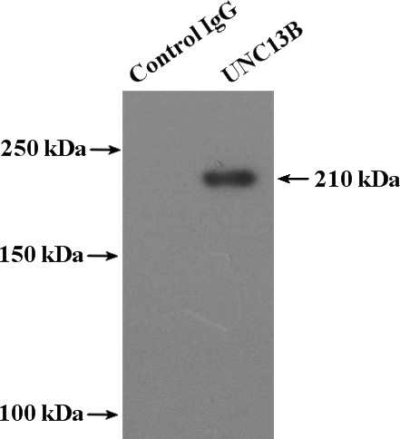 IP Result of anti-UNC13A (IP:Catalog No:116572, 4ug; Detection:Catalog No:116572 1:500) with mouse brain tissue lysate 5200ug.