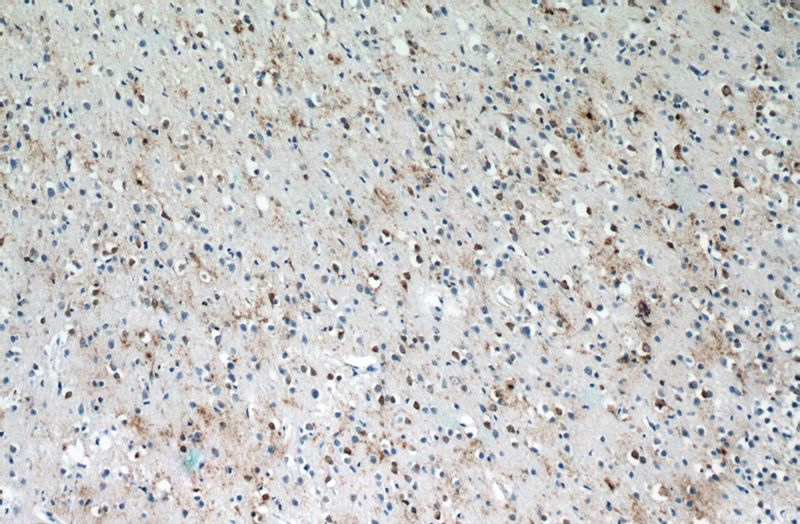 Immunohistochemistry of paraffin-embedded human brain tissue slide using Catalog No:111667(RABL4 Antibody) at dilution of 1:50 (under 10x lens)