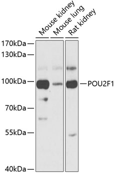 Western blot - POU2F1 Polyclonal Antibody 