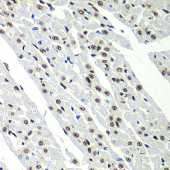 Immunohistochemistry - SF3B2 Polyclonal Antibody 